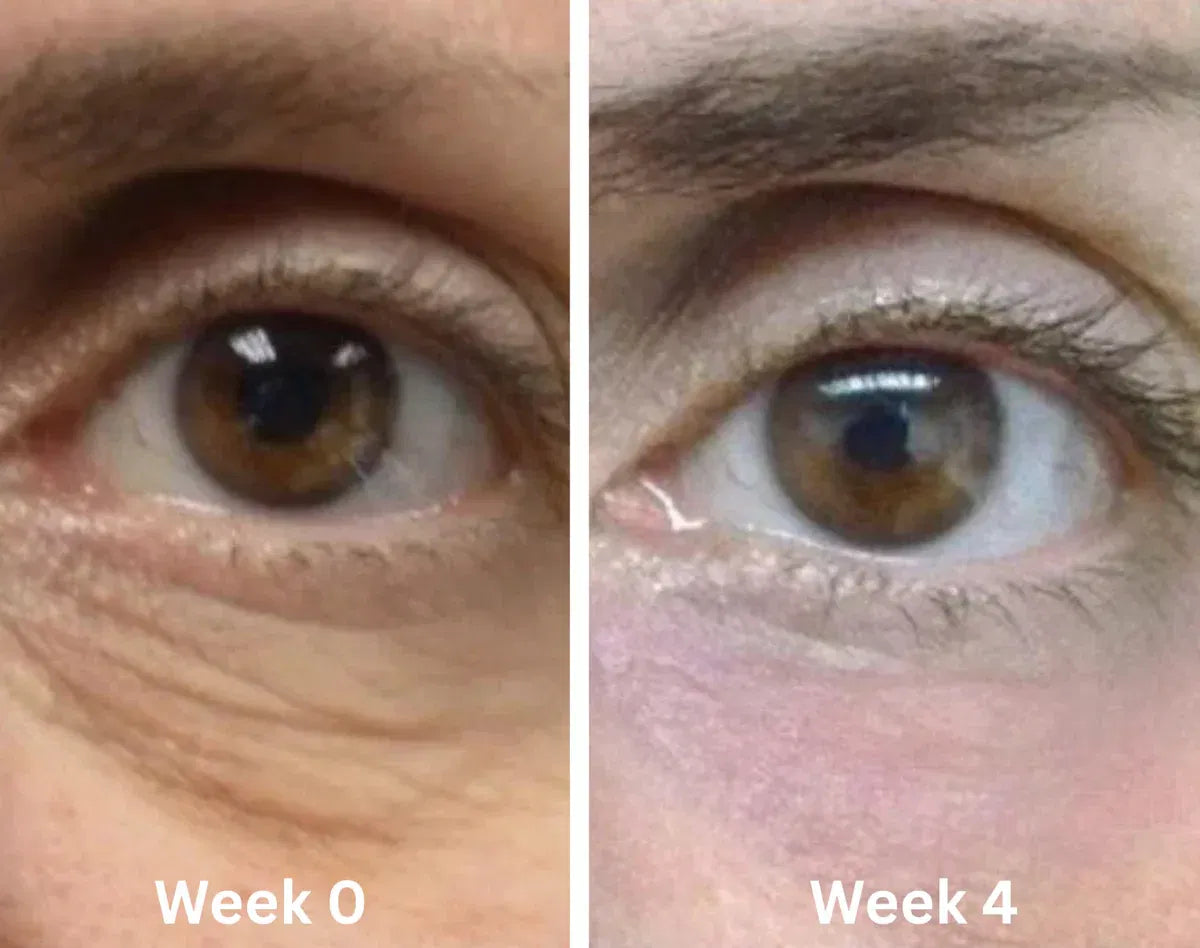 Brighter eyes in 10 minutes